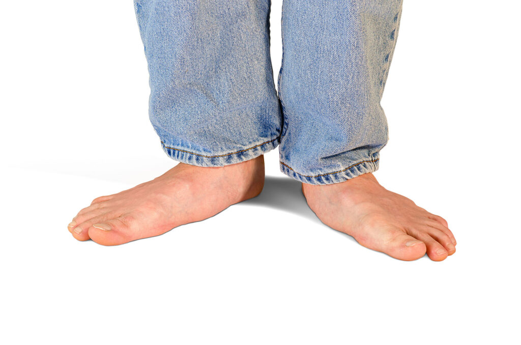Pieds plats adultes